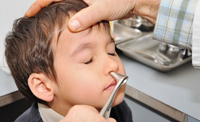 Viêm xoang ở trẻ em: Nguyên nhân, biểu hiện và cách chữa trị, phòng ngừa