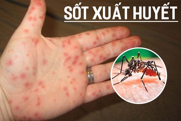 Video tuyên truyền phòng chống sốt xuất huyết