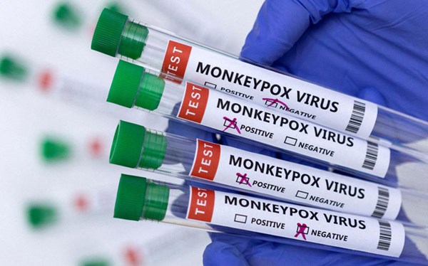 Bệnh đậu mùa khỉ: Dấu hiệu và cách phòng tránh